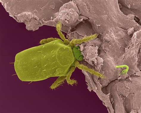 Chigger Mite (trombicula Sp.) Photograph by Dennis Kunkel Microscopy ...