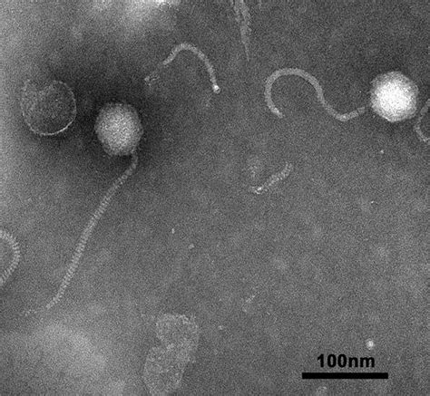 Transmission electron microscope image of phage JH01 | Download ...