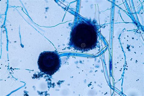 Aspergillus Niger Under Microscope