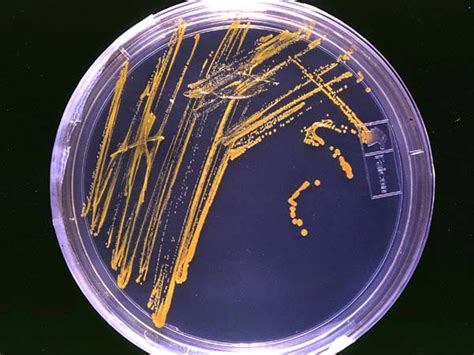 Preparation of Lysogeny broth (LB) agar plates | Protocols Online