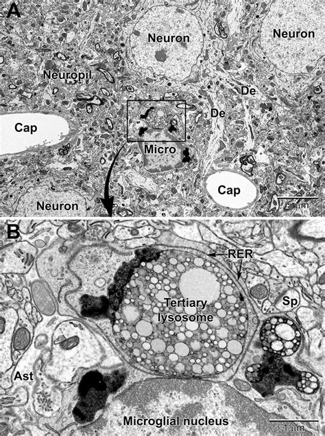 Human Brain Cells Under A Microscope