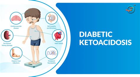 Diabetic Ketoacidosis: Causes, Symptoms, Treatment, and Prevention ...