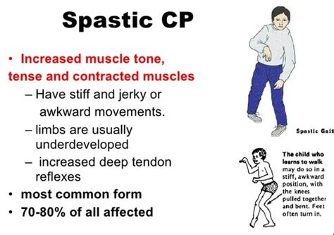 Spastic Cerebral Palsy - Cause, Symptoms, Treatment, Exercise