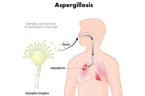 Preventing Aspergillus Contamination in Cannabis Crops - Omega ...