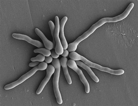 A. fumigatus Archives - Aspergillus and Aspergillosis