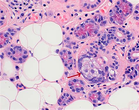 Parotid Histology