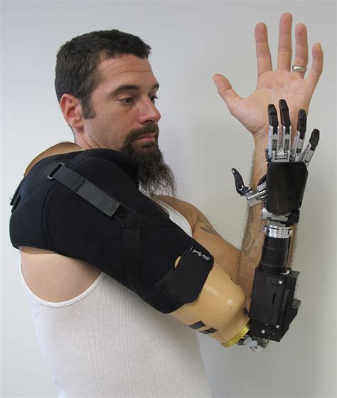 Bionic Arm