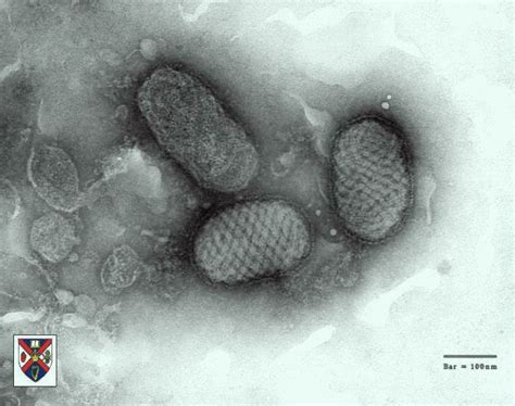 A negatively stained poxvirus courtesy of the creators of http://www ...