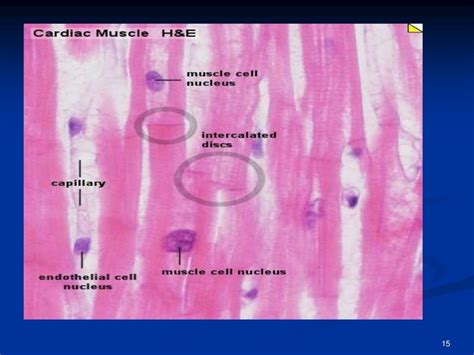 Histology of cardiac muscle