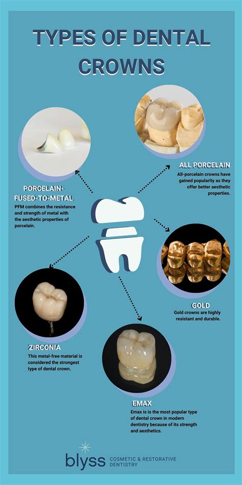 Types of Dental Crowns: Insider Tips to Choose the Best One for You