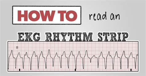 Ekg Practice Strips Printable