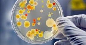 Incubation Time and Conditions of Active or Passive Air SCDA Plates ...