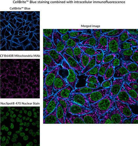 Tech Tip: Combining Lipophilic Membrane Dyes with Immunofluorescence ...