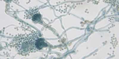 CAR T cells attack fungal infections | Drug Discovery News