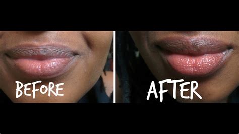 How I Exfoliate My Lips| DIY Lip Exfoliation With Sugar - YouTube