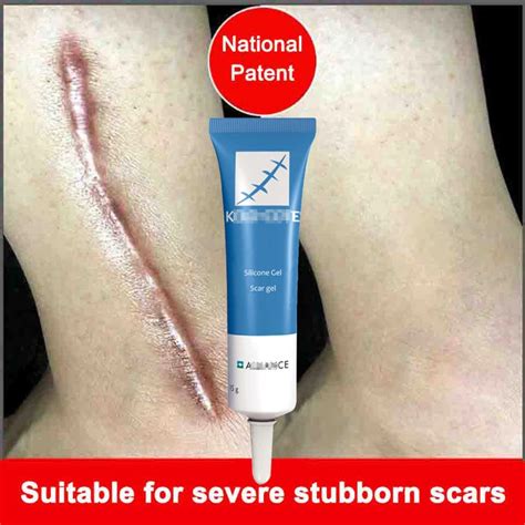 Scar Removal Cream Acne Scars Gel Stretch Marks Surgical Scar | Etsy