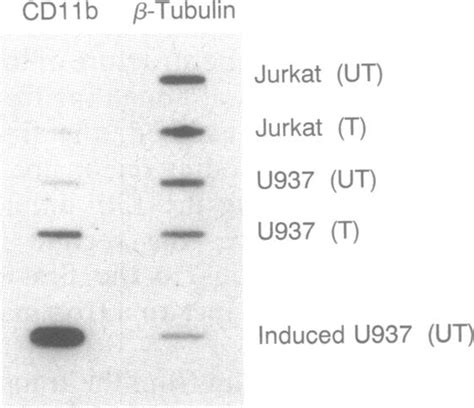 The promoter of the CD11b gene directs myeloid-specific and ...