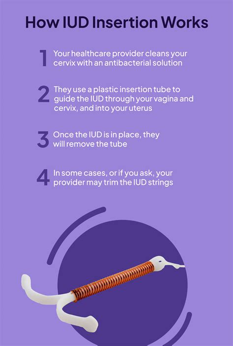 IUD Insertion: How It Works And What To Expect, 45% OFF