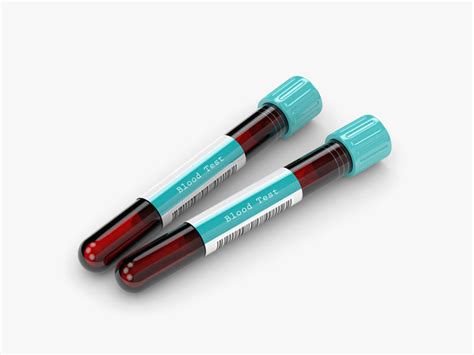 Blood Urea Nitrogen (BUN) Test