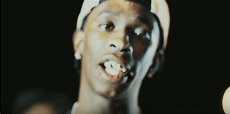 Young Thug Teeth Before And After - Download Golden Teeth Young Thug ...