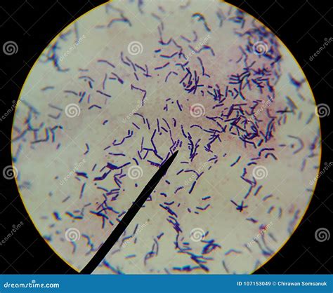 Bacteria Cells Finding With Microscope. Stock Image | CartoonDealer.com ...