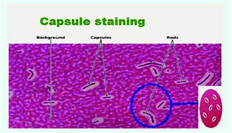 Capsule staining. Capsule straining is neggative staining techniques ...