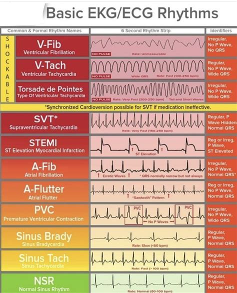 Pin by kids education on medical education | Nursing school survival ...