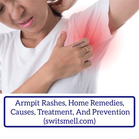 Armpit Rashes | Home Remedies, Causes, Treatment, And Prevention ...