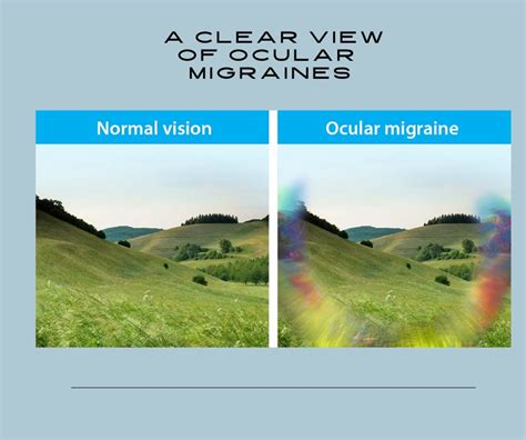 What Is an Ocular Migraine? | Florida Eye Microsurgical Institute