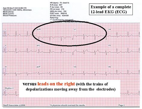 eHeart: Introduction to ECG EKG