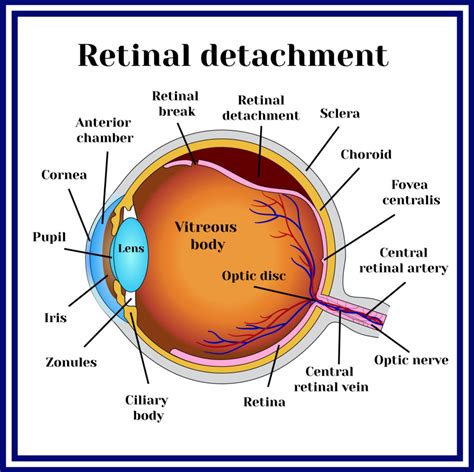 Services Archives - Retina Vitreous Consultants, Inc