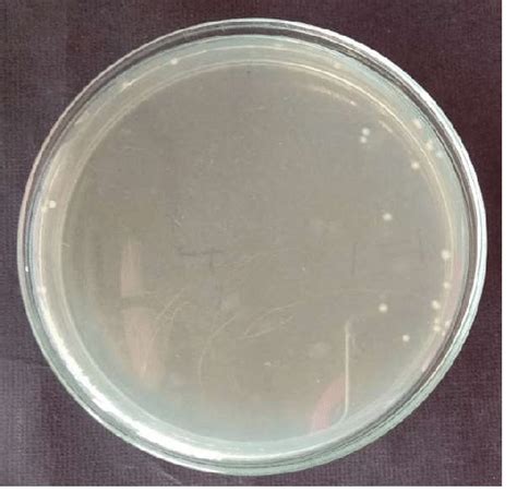 Nutrient Agar media showed the bacterial growth of sample C in fourth ...