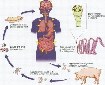 Tapeworm Infection Causes, Symptoms, Diagnosis and Treatment - Natural ...