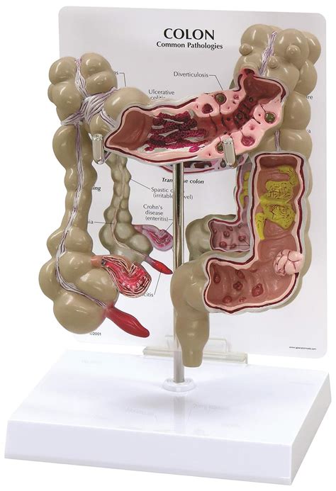 Human Anatomy Colon - Anatomy Book