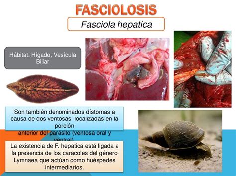 Fasciola