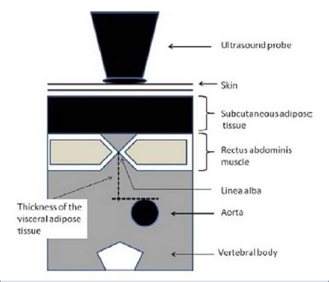 Visceral fat measurement. | Download Scientific Diagram