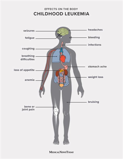 11 symptoms of leukemia in children