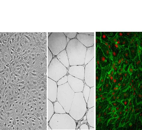 Pre-screened endothelial cells validated for signalling biomarkers ...