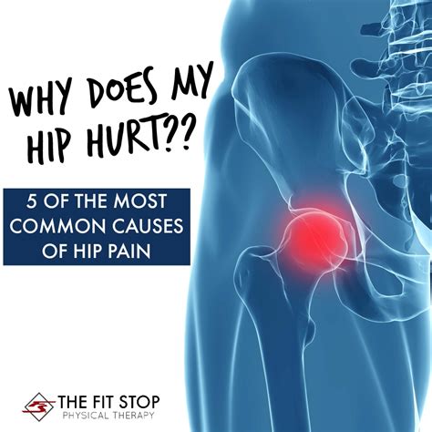 Most common causes of hip pain | Fit Stop Physical Therapy