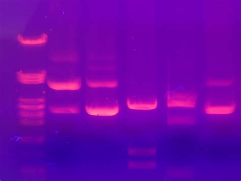 Agarose gel electrophoresis - wikidoc