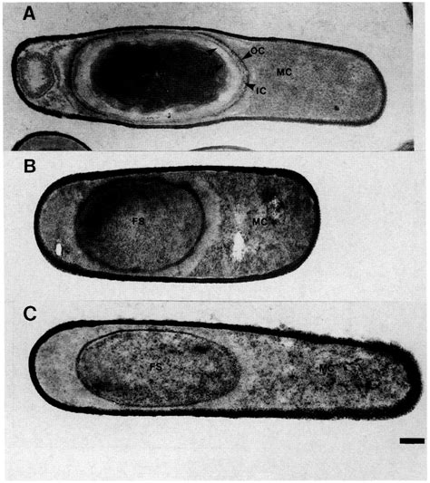 Morphology of wild-type and mutant sporangia. Shown are electron ...