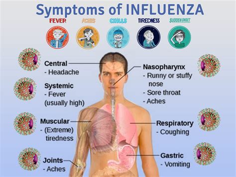 Influenza - causes, symptoms and treatment of flu | Health Care "Qsota ...