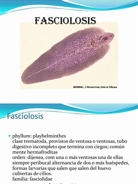 FASCIOLOSIS | Especialidades Medicas | Medicina CLINICA | Prueba ...