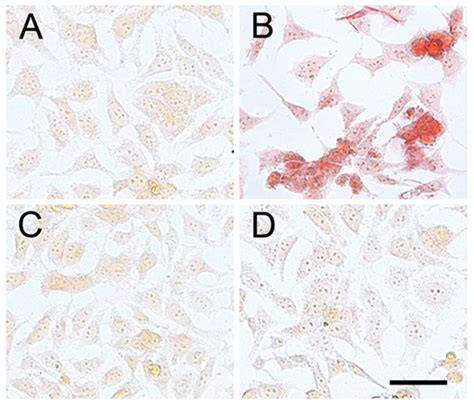 Congo red staining showing the increased internalization in β ...