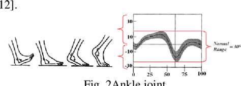 Figure 1 from Classification of hemiplegic gait using kinetic data on ...