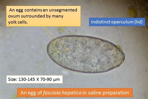 Fasciola: Introduction, Morphology, Life Cycle, Pathogenecity, Laboratory