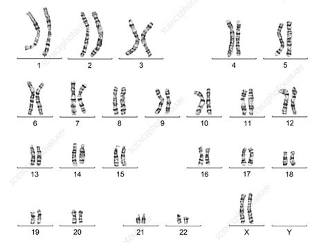 Human female karyotype - Stock Image - C016/6742 - Science Photo Library