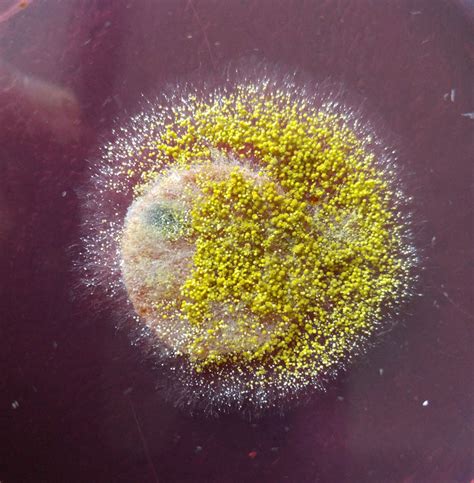 Aspergillus flavus | Mold Xperts