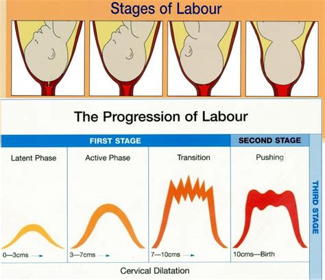 My Rhythm of Life: Understanding the Stages of Labour is Laborious