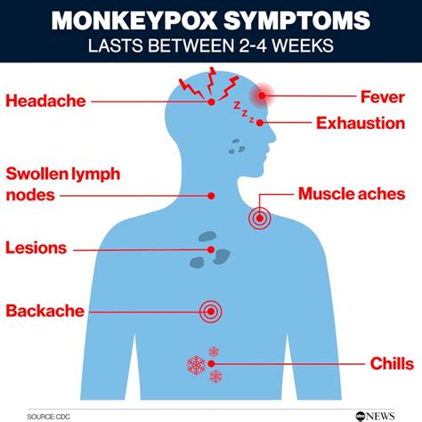 Monkeypox cases up 77% in 1 week: WHO - ABC News